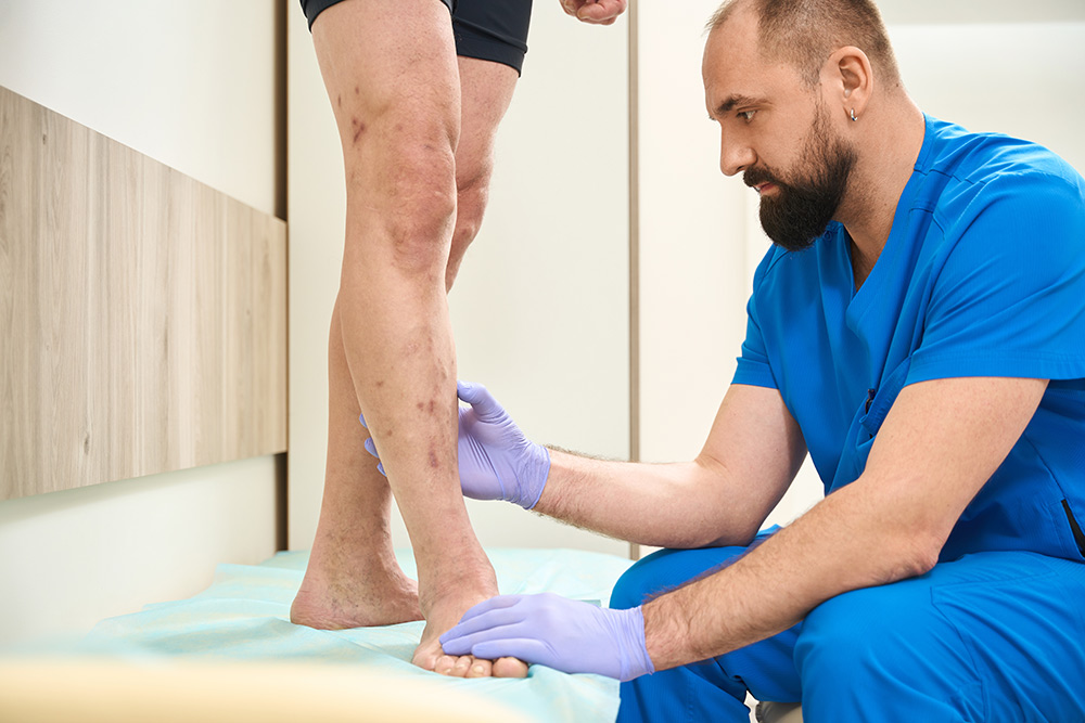 Leg Pain, Cramping, or Numbness? Here’s What to Know About PAD