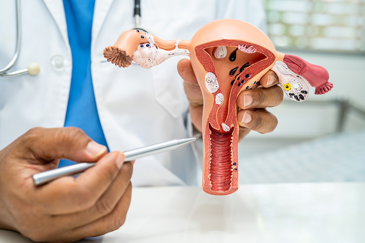 La importancia de hacerse un cribado