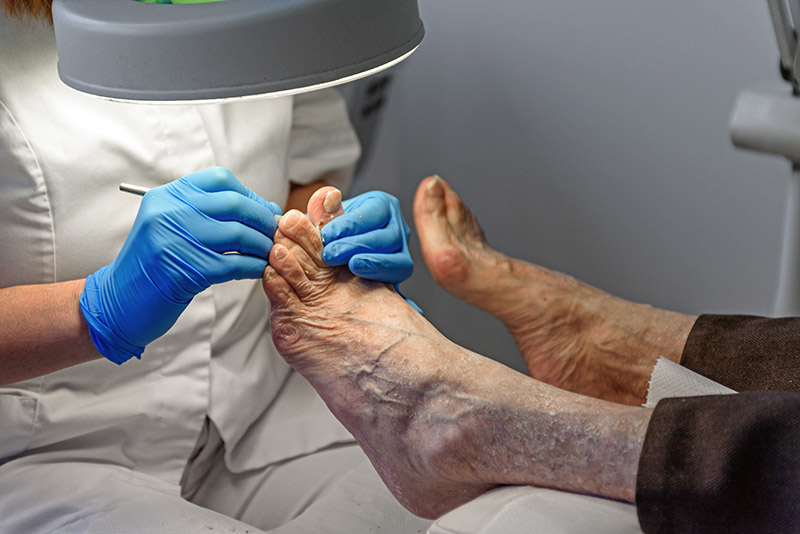 Why You Need a Podiatrist on Your Diabetes Care Team Why You Need a Podiatrist on Your Diabetes Care Team